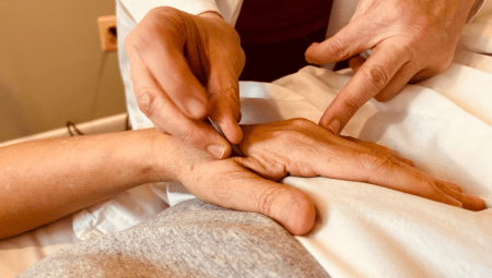 Your Body Keeps the Score, And Acupuncture Helps It Let Go