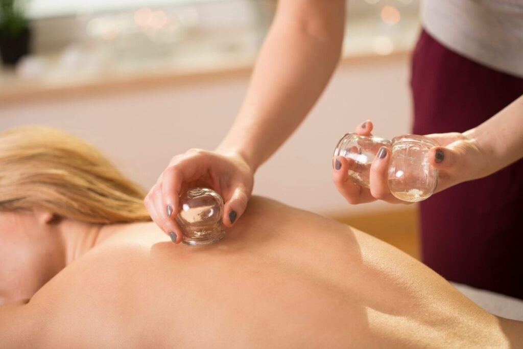 Cupping therapy at The Teal Center