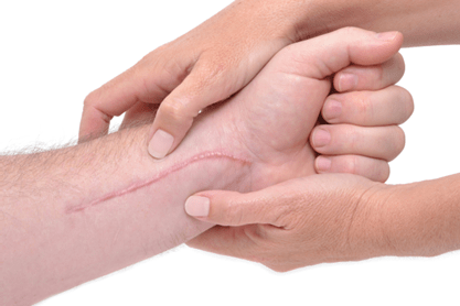 Scar Work at The Teal Center